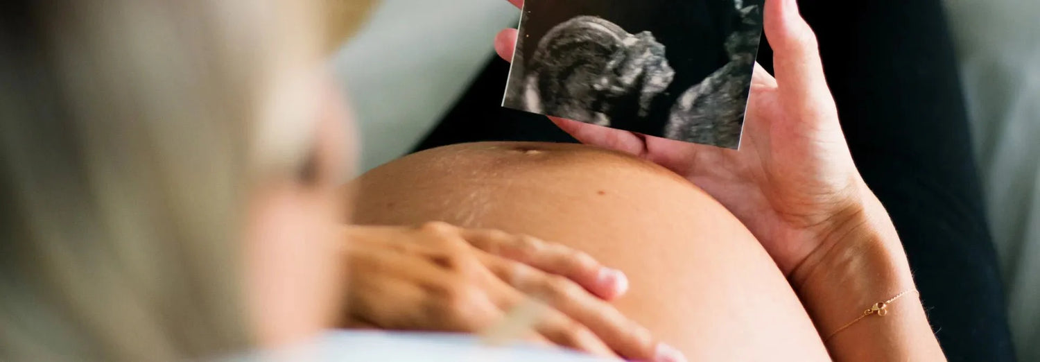 Fertilidad